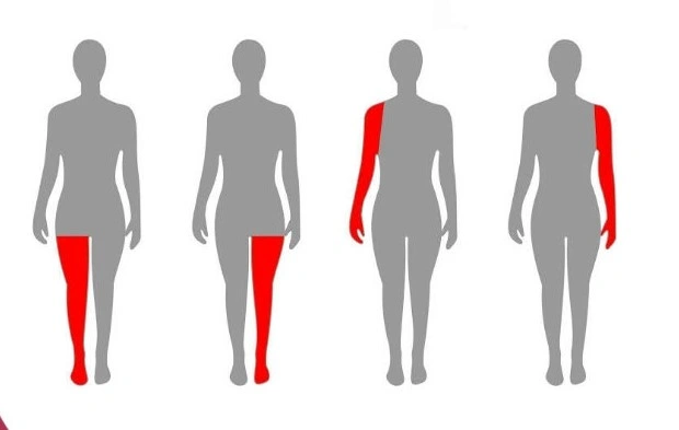 Stroke - Natural Treatment at Deepak Nature Cure