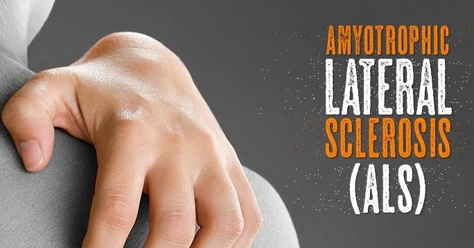 Alzheimer's disease - Natural Treatment at Deepak Nature Cure