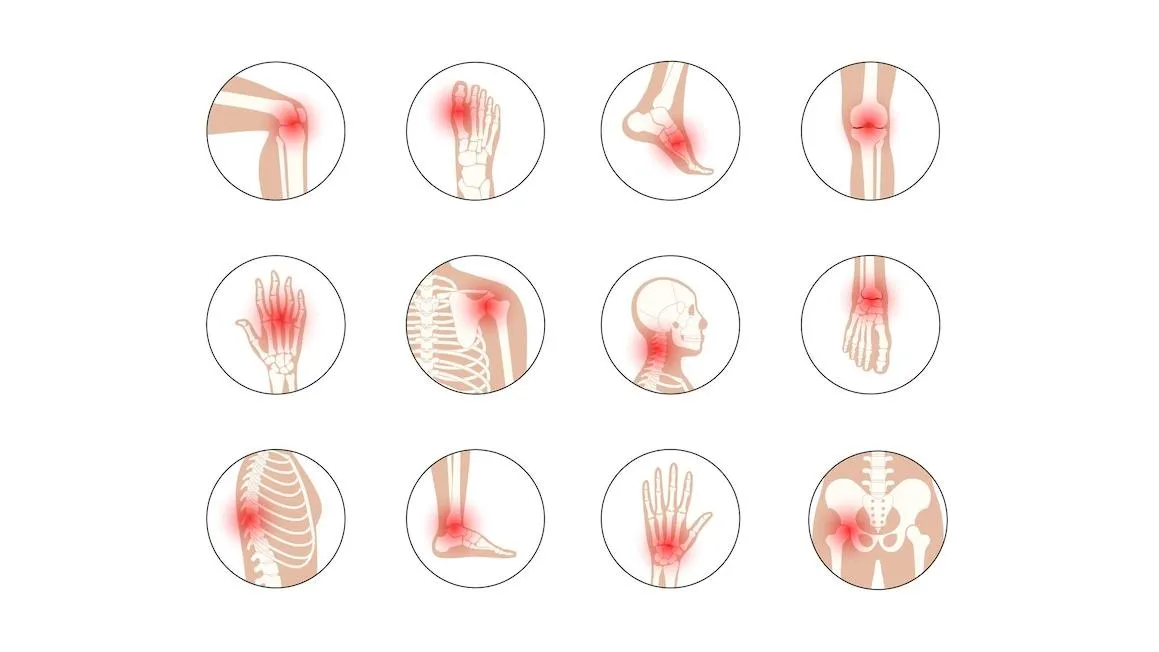 Naturopathic Osteoarthritis Relief in Hosur & Dharmapuri